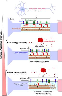 Homeostatic plasticity of axonal excitable sites in Alzheimer's disease